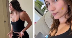Hailey Bieber reveals she has TWO Ovarian Cysts Hailey Bieber reveals she has TWO Ovarian Cysts