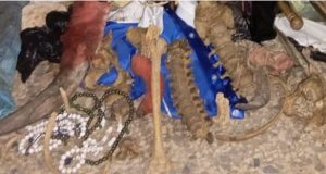 THREE arrested for trading in human parts THREE arrested for trading in human parts