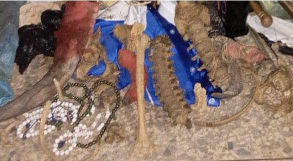 THREE arrested for trading in human parts THREE arrested for trading in human parts