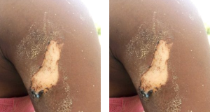 Osun tailor allegedly burns customer with hot iron Osun tailor allegedly burns customer with hot iron