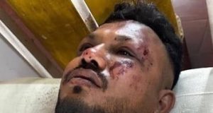 One out of 242 passengers, survives Ahmedabad Plane crash One survivor of Ahmedabad Plane crash rescued