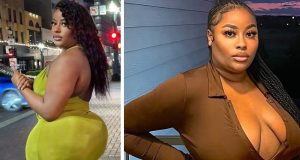 Influencer shares her terrifying BBL ordeal Influencer shares her terrifying BBL ordeal