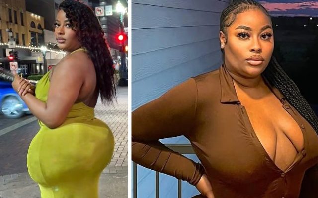 Influencer shares her terrifying BBL ordeal