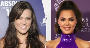 Khloe Kardashian reveals EVERY cosmetic surgery she’s ever had done Khloe Kardashian reveals EVERY cosmetic surgery she's ever had done
