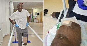 Nigerian man loses his leg after home pedicure went wrong Nigerian man loses his leg after home pedicure went wrong