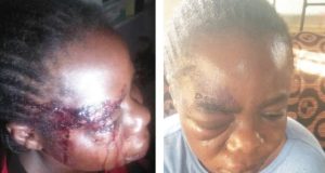 Police nab man for brutal assault on wife Police nab man for brutal assault on wife