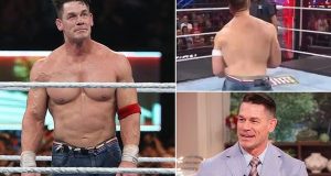 John Cena admits he had a hair transplant John Cena admits he had a hair transplant