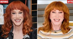 Kathy Griffin confirms THIRD facelift Kathy Griffin confirms THIRD facelift
