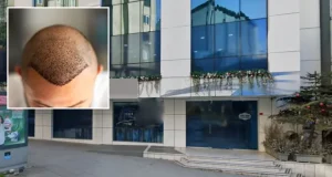 Man d!es after Turkey hair transplant goes wrong Man d!es after Turkey hair transplant goes wrong