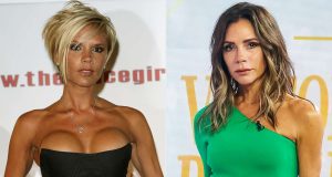 Victoria Beckham reveals she removed her nineties boob job Victoria Beckham reveals she removed her nineties boob job