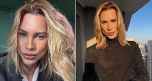 Influencer Junior Dutra d!es at 31 after alleged ‘fox eyes’ procedure Influencer Junior Dutra