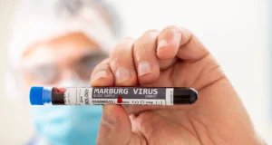Ethiopia confirms first Marburg outbreak Ethiopia confirms first Marburg outbreak