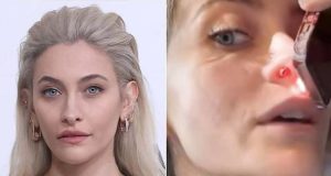 Paris Jackson reveals drug use has caused a hole in her nose Paris Jackson reveals drug use has caused a hole in her nose