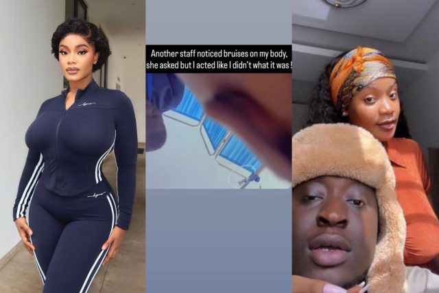 Carter Efe's babymama shares more photos alleging abuse