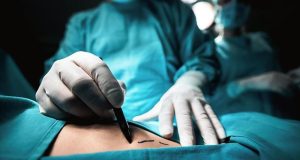 Men getting twice as much plastic surgery, new data shows Men getting twice as much plastic surgery, new data shows