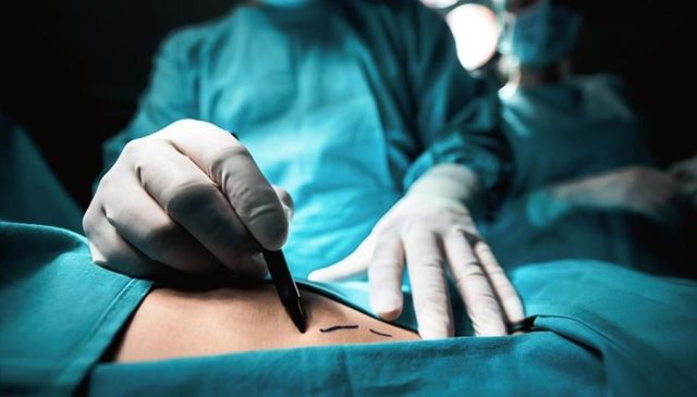 Men getting twice as much plastic surgery, new data shows Men getting twice as much plastic surgery, new data shows