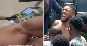 Anthony Joshua undergoes treatment on ribs Anthony Joshua undergoes treatment on ribs