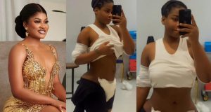 Phyna shares new look 3 days after BBL surgery Phyna shares new look 3 days after BBL surgery