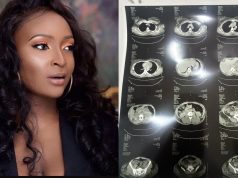 Blessing CEO sparks fresh reactions as she shares medical scan after public apology over cancer controversy