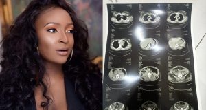 Blessing CEO sparks fresh reactions as she shares medical scan after public apology over cancer controversy Blessing CEO Returns With Scan Upload Following Backlash Over Cancer Allegations