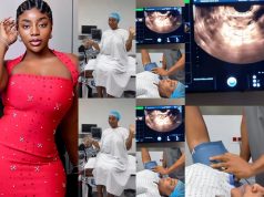 Ashmusy freezes her eggs at 30 to preserve fertility Ashmusy freezes her eggs