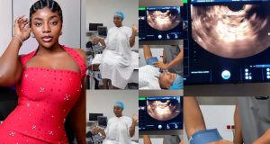 Ashmusy freezes her eggs at 30 to preserve fertility Ashmusy freezes her eggs