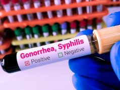 Gonorrhea and syphilis skyrocket in Europe Gonorrhea and syphilis skyrocket in Europe