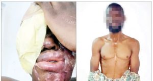 I got N500,000 to bathe spa worker with acid – Suspect I got N500,000 to bathe spa worker with acid - Suspect
