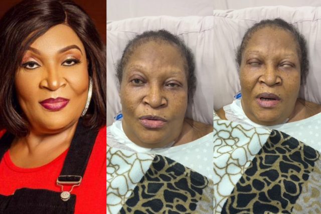 Ngozi Nwosu appeals for financial help to undergo surgery