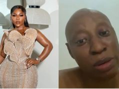 Cynthia Anijekwu receives N13m in donations for cancer treatments Cynthia Anijekwu receives N13m in donations for cancer treatments m