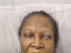 Ngozi Nwosu faces complications after surgery