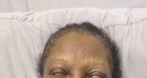 Ngozi Nwosu faces complications after surgery