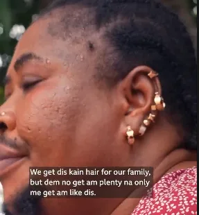 Woman living with facial hair voices out3
