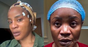 Uche Ogbodo shows off face first day after surgery Uche Ogbodo shows off face first day after surgery