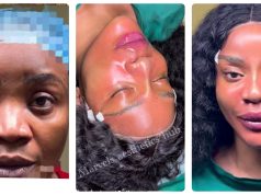 Uche Ogbodo unveils ‘new face’ after facial rejuvenation
