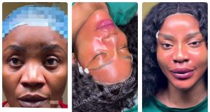 Uche Ogbodo unveils NEW LOOK after facial rejuvenation