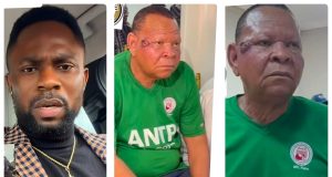 Dr Moore urges Elesho to see dermatologist over facial lesion