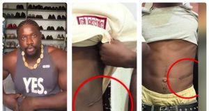 VeryDarkMan reveals how young man was LURED for kidney removal