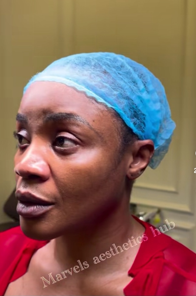 Uche Ogbodo unveils NEW LOOK after facial rejuvenation 2 Screenshot 20260813 154212 Instagram