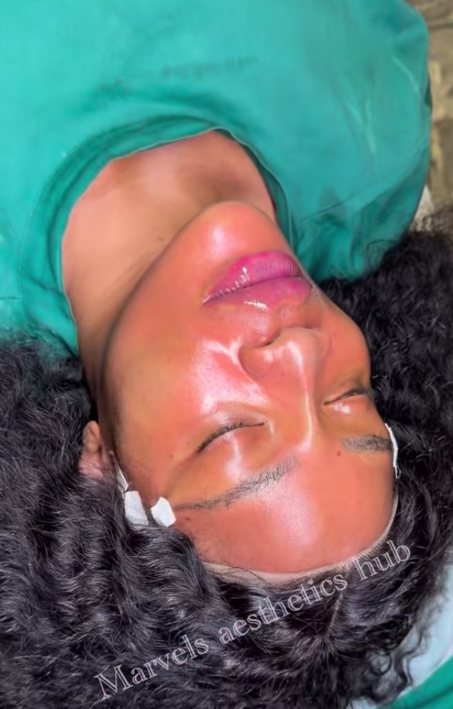 Uche Ogbodo unveils NEW LOOK after facial rejuvenation 6 Screenshot 20260813 154302 Instagram