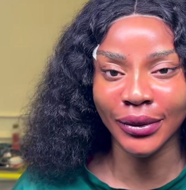Uche Ogbodo unveils NEW LOOK after facial rejuvenation 1 Screenshot 20260813 154315 Instagram
