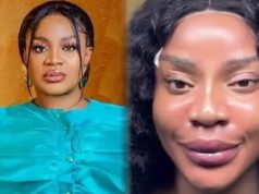 Day 3 of Uche Ogbodo’s facial rejuvenation journey Uche Ogbodo