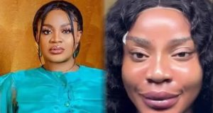 Day 3 of Uche Ogbodo’s facial rejuvenation journey Uche Ogbodo