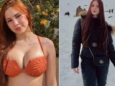 Influencer d!es @ 22 weeks after getting bre.ast reduction surgery Influencer d!es @ 22 weeks after getting bre.ast reduction surgery