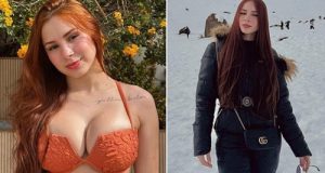 Influencer d!es @ 22 weeks after getting bre.ast reduction surgery Influencer d!es @ 22 weeks after getting bre.ast reduction surgery
