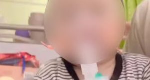 Nurse accidentally ‘cuts off one-year-old boy’s finger with scissors’ Nurse accidentally 'cuts off one-year-old boy's finger with scissors'