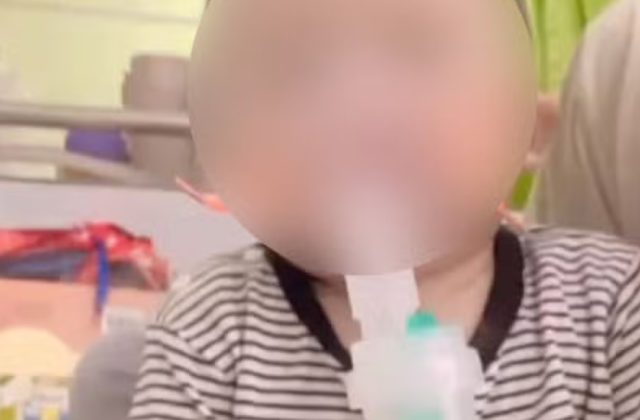 Nurse accidentally 'cuts off one-year-old boy's finger with scissors' Nurse accidentally 'cuts off one-year-old boy's finger with scissors'